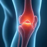 Lesão de Wrisberg: ligamento meniscofemoral e dor